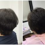 50代くせ毛絶壁ボリューム広がる悩みに【骨格補正立体3Dカット】の神戸くせ毛専門美容室アバディ